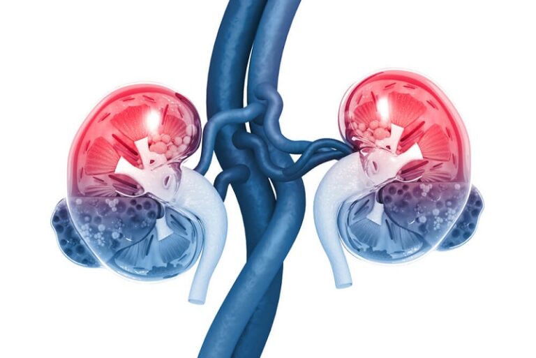 Causes of Kidney Dysfunction